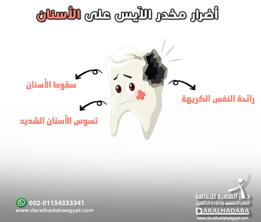 أضرار الاَيس على الأسنان